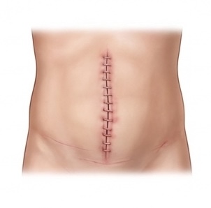 Post-Operative Wound care icon