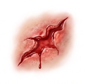 Traumatic Wound care icon