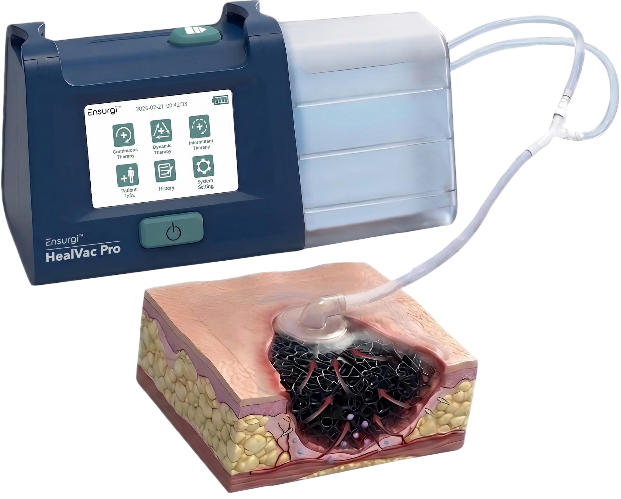 Ensurgi HealVac Pro NPWT System — Portable Negative Pressure Wound Therapy Device with Intelligent Pressure Control